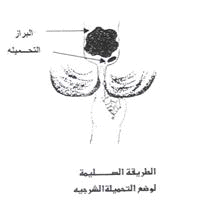 GIT%20(4).gif