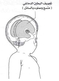 Hydr%20%281%29.gif