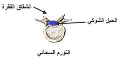 mening%20%281%29.gif