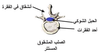 occ%20%281%29.gif