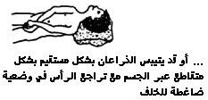 الشلل الدماغي؟ CP-B%20(3).jpg