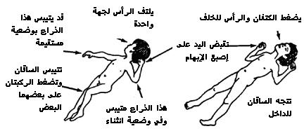 الشلل الدماغي؟ CP-B.jpg