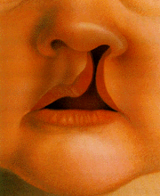 Cleft_LP%20%281%29.gif