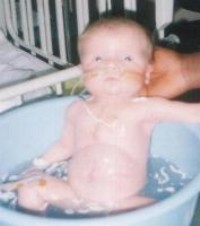 DiGeorge_Syndrome%20(5).jpg