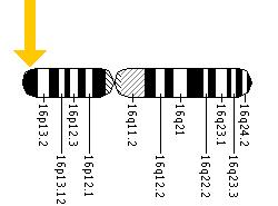    Rubinstein-Taybi Syndrome Rubinstein-Taybi%20(